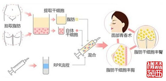 赫西儀器成功打造PRP美容離心機(jī)